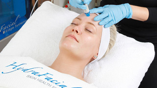 HydraFacial – Das Anti-Aging Wunder der Filmstars